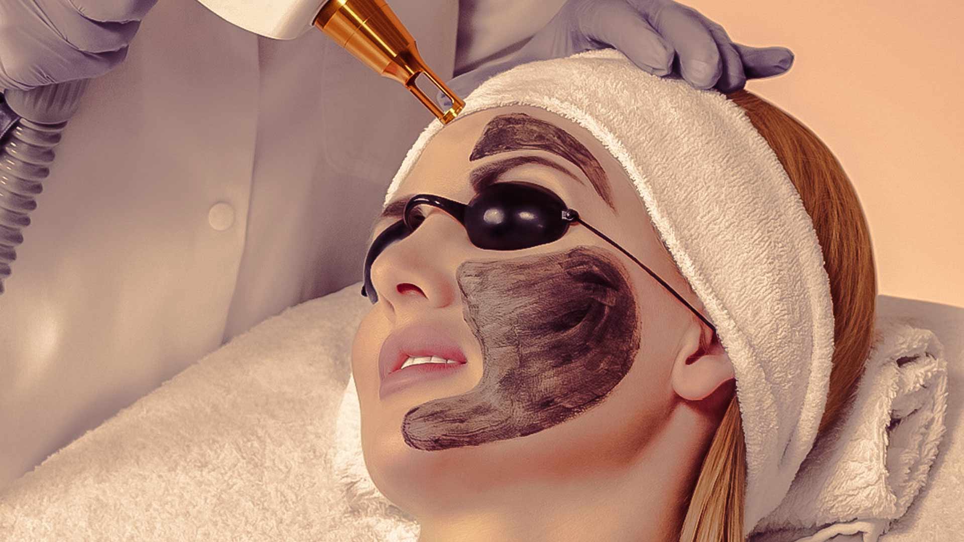 Carbon Laser Facial Cost Delhi Garekars M.D. Dermatology Clinic